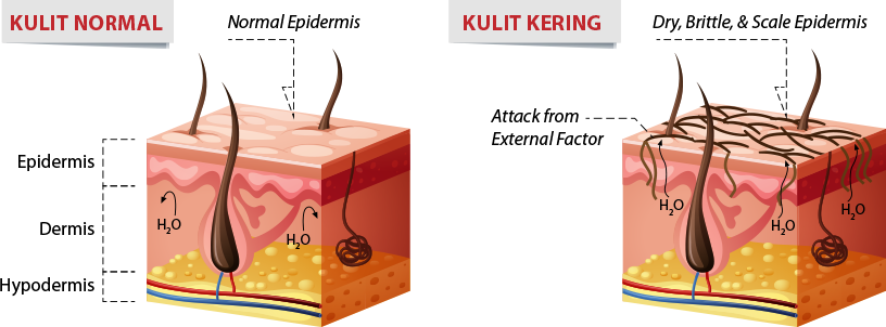 KULIT NORMAL VS KULIT KERING